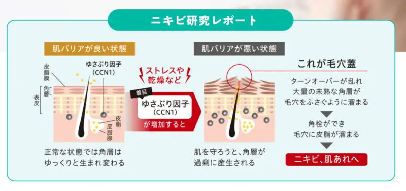 【どっちがいい？】プロアクティブとファンケルのニキビケアの違いを5つの項目で比較