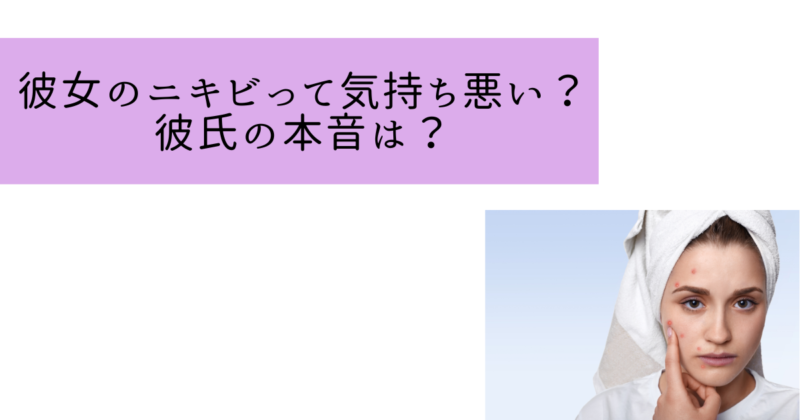 彼女のニキビって気持ち悪い？彼氏の本音は？ニキビ治療法を段階別に解説